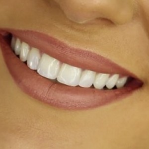 Orthodontic Dentistry: For Healthy Teeth and Beautiful Smile (Image courtesy Liz20151222 on Wikimedia Commons via CC BY-SA 4.0 International)