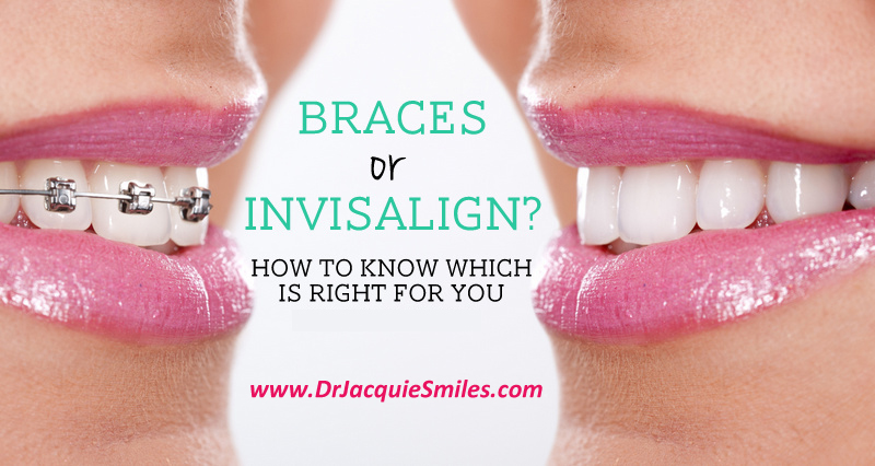 braces-or-invisalign-NYC-Dr-Jacquie-Smiles