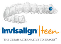 Invisalign-Teen-clear-braces