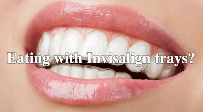 Can I Drink Tea With My Invisalign? 